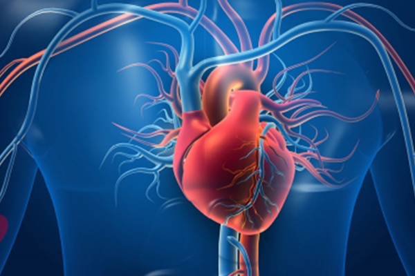 cardiac catheterization